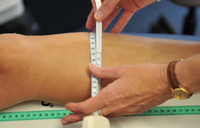Bekentenis Permanent helemaal Steunkousen aanmeten - ProReva | Orthopedisch maatwerk | orthopedisch maatwerk Bekentenis Permanent helemaal Steunkousen aanmeten - ProReva | Orthopedisch maatwerk | orthopedisch maatwerk